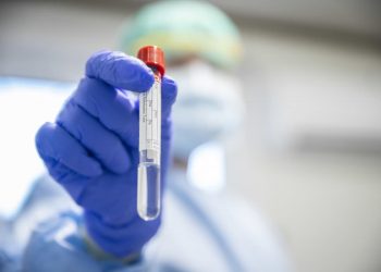 4 فئات مستبعدة من أخذ لقاح كورونا.. تعرف عليهم