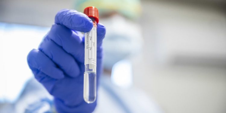 4 فئات مستبعدة من أخذ لقاح كورونا.. تعرف عليهم