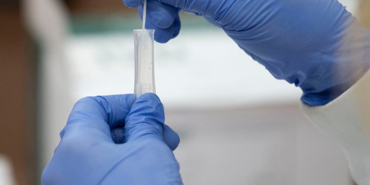 الصحة العالمية تسجل أعلى معدل إصابات أسبوعي بكورونا منذ بداية الجائحة