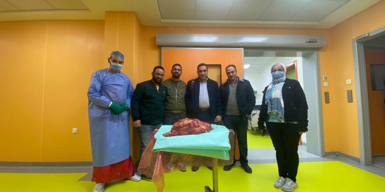 في 6 ساعات.. فريق طبي ينقذ حياة مريض باستئصال ورم خبيث وزنه 30 كجم
