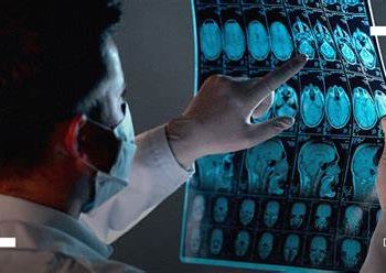 مفاجأة.. دراسات تثبت تأثير كورونا على الجهاز العصبي