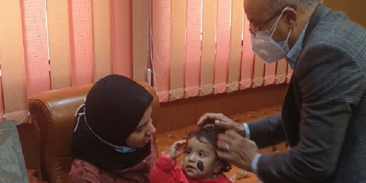 جامعة المنصورة تستقبل طفلة نبروه التي عراها والدها لعلاجها