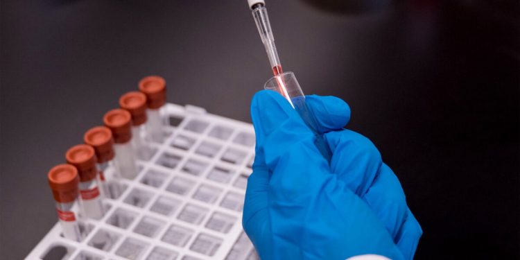 بأدلة جديدة صادمة.. أزمة تسرب كورونا من مختبر صيني تشتعل مرة أخرى