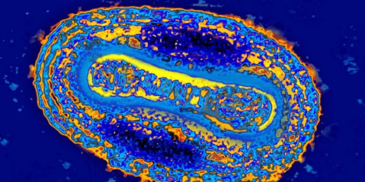 بريطانيا تكشف عن حالات إصابة جديدة بفيروس نادر
