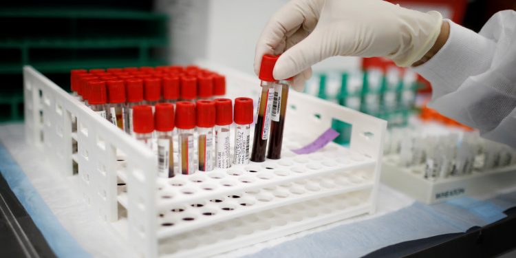 بنسب نجاح عالية.. اختبار دم يكشف عن 50 نوع من السرطان
