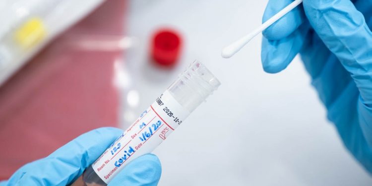 للتغيب عن المدرسة.. طلاب يستخدمون عصير الليمون في تزييف اختبارات كورونا