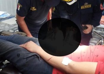 استغرقت 6 ساعات…«طوارئ طنطا الجامعي» تنقذ يد شاب من البتر بعد انزلاق كفه في المفرمة