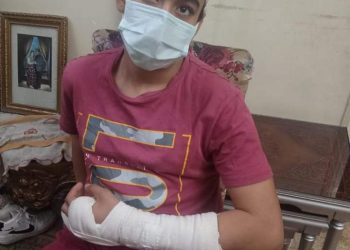 بالصور.. طالب ثانوي يُصيب زميله بـ"7 غرز" ويكسر يده .. وأسرته تطالب الوزارة بالتدخل 