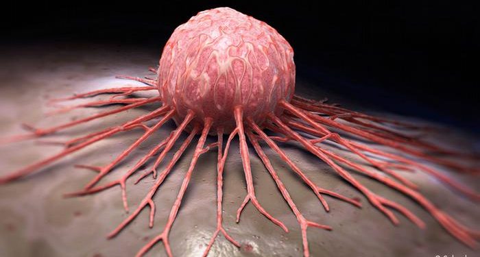 باحثان مصريان يكشفان وسيلة جديدة للتنبؤ باستجابة أورام السرطان للعلاج عن طريق عينة بالدم