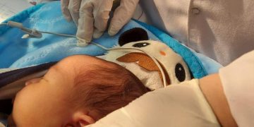 الصحة: فحص مليونين و467 ألف طفل ضمن مبادرة الاكتشاف المبكر وعلاج ضعف وفقدان السمع