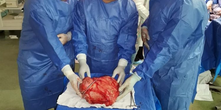 فريق طبي بمستشفي سوهاج الجامعي ينجح فى استئصال ورم يزن 18 كجم