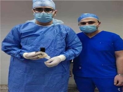 استخراج «هاتف محمول» من بطن شاب في مستشفى بنها الجامعي