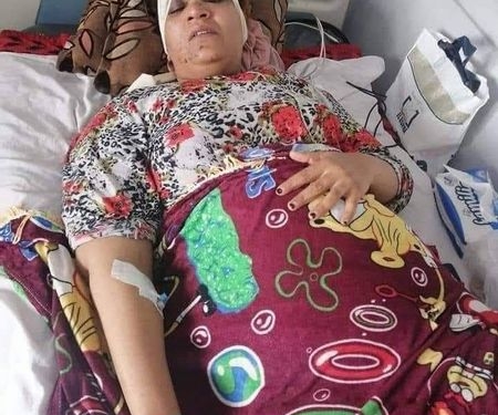 بـ 100 غرزة.. أسرة طالب تعتدي على معلمة وتصيبها بجروح بالغة بسبب "الباص"