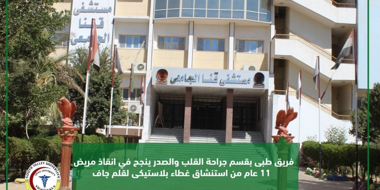 فريق طبي بمستشفى قنا الجامعي ينجح في انقاذ طفل استنشق غطا قلم جاف