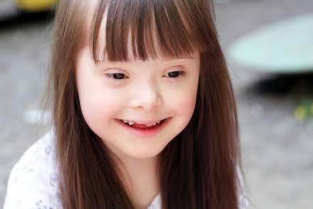 مؤتمر وحفل لاختيار ملك وملكة جمال الأطفال من ذوي الإعاقة