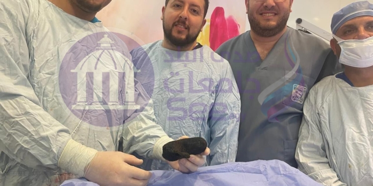 بتأكل شعرها.. تفاصيل إنقاذ حياة طفلة مصابة بمرض نادر بمستشفى أبو الريش