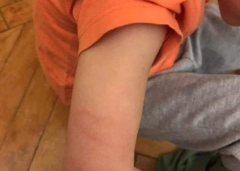 حبس مديرة حضانة عذبت الأطفال 8 سنوات بالإسكندرية