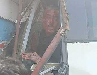 إصابة 10 طلاب من جامعة حورس في حادث تصادم بجمصة