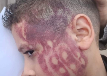 خبير نفسي يكشف أسباب تكرار حالات اعتداء المعلمين على الطلاب