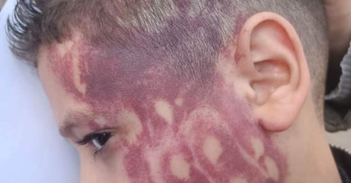 خبير نفسي يكشف أسباب تكرار حالات اعتداء المعلمين على الطلاب