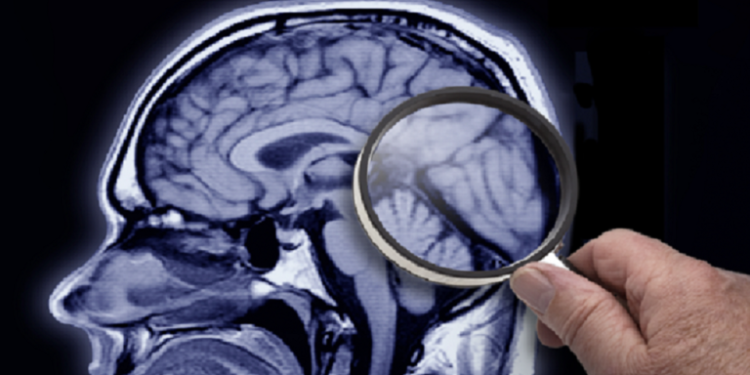 علماء بطرسبورج يبتكرون عقارا يحفظ الذاكرة