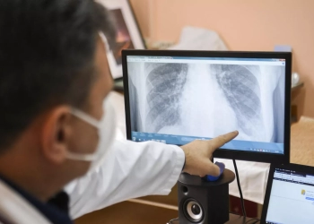 علماء يبتكرون "نسخة طبق الأصل" من رئة بشرية