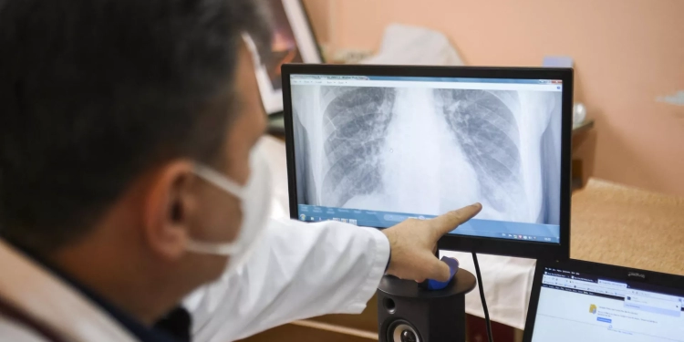 علماء يبتكرون "نسخة طبق الأصل" من رئة بشرية