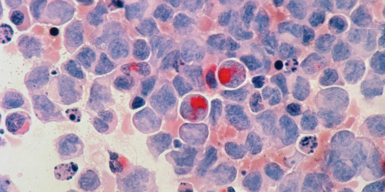 علماء يبتكرون نظاما اصطناعيا لتخثر الدم يسرع شفاء الجروح