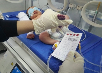 الصحة: فحص 469 ألف طفل حديث الولادة ضمن مبادرة الكشف المبكر عن الأمراض الوراثية