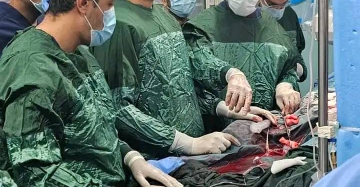 نجاح الفريق الطبي بمعهد القلب بإجراء قسطرة معقدة بإستخدام جهاز الإيكمو ECMO