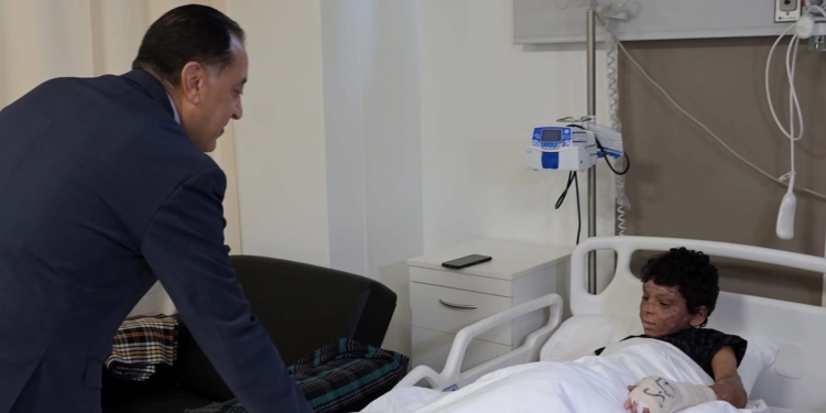 دعم حكومي جديد لمستشفى أهل مصر.. صرح طبي لإنقاذ ضحايا الحروق”