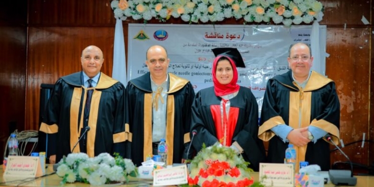 رسالة دكتوراه بطب بنها تبتكر أسلوبًا منخفض التكلفة لعلاج جلوكوما الأطفال