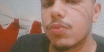 تشويه وجه طالب بجامعة القاهرة.. ومطالب للداخلية بضبط الجناه.. أعرف التفاصيل