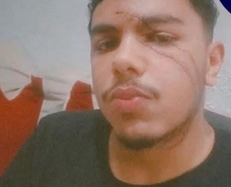 تشويه وجه طالب بجامعة القاهرة.. ومطالب للداخلية بضبط الجناه.. أعرف التفاصيل