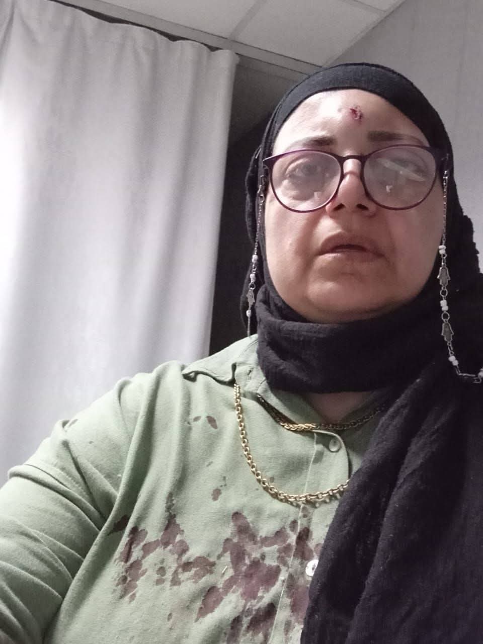 «المعلمين» تتحرك لدعم رئيسة كنترول الشهادة الإعدادية لتعرضها للاعتداء داخل ميكروباص