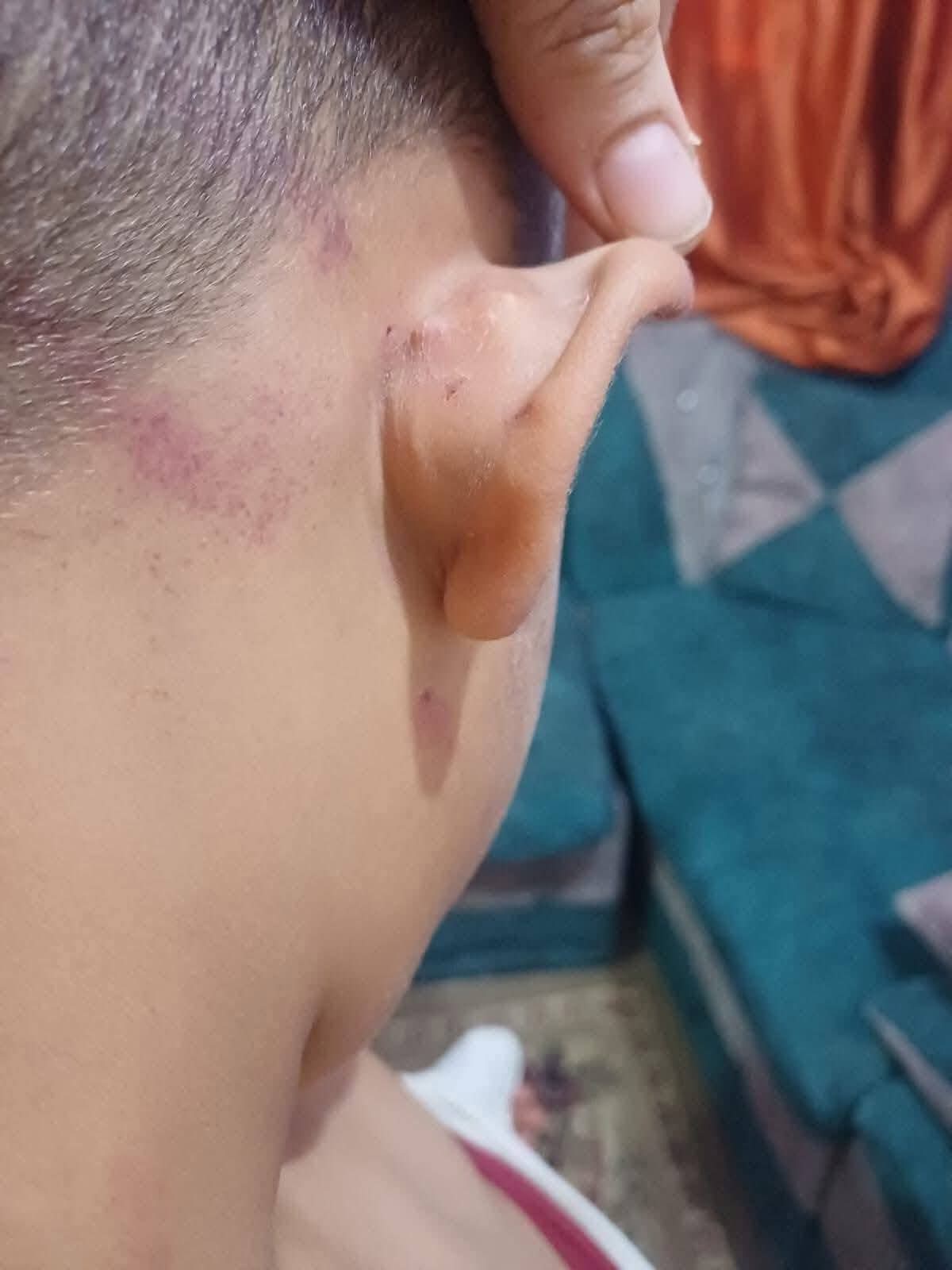 محافظ سوهاج يقرر وقف ونقل معلمة ضربت تلميذ ابتدائي بخرطوم أنبوبة «تفاصيل» 