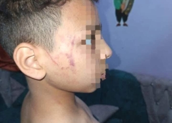 محافظ سوهاج يقرر وقف ونقل معلمة ضربت تلميذ ابتدائي بخرطوم أنبوبة «تفاصيل»