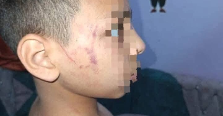 محافظ سوهاج يقرر وقف ونقل معلمة ضربت تلميذ ابتدائي بخرطوم أنبوبة «تفاصيل»