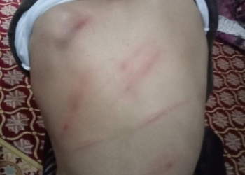 أصيب بتشنجات عصبية.. واقعة صادمة داخل مدرسة.. تفاصيل اتهام مديرة بالتعدي على طالب