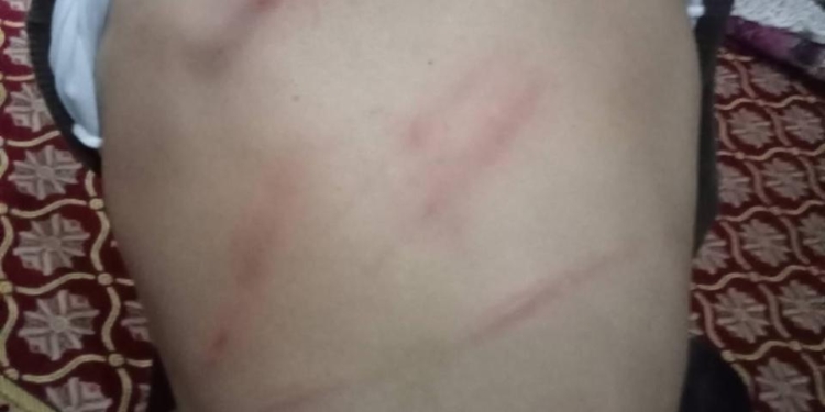 أصيب بتشنجات عصبية.. واقعة صادمة داخل مدرسة.. تفاصيل اتهام مديرة بالتعدي على طالب